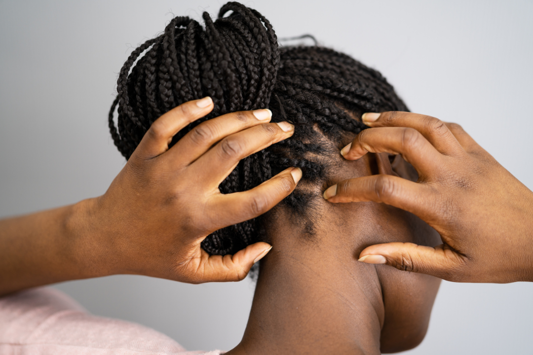 The Importance of Scalp Care