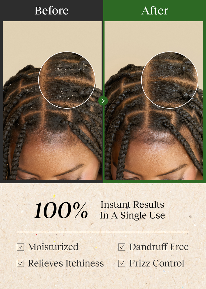 Bephor Braid Rev Scalp Cleansing Toner